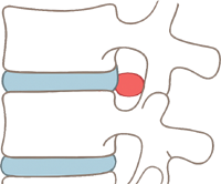 Schema_eine_riesigen_BSV